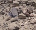 استشهاد 385 وإصابة 342 من المدنيين العزل بالعاصمة اليمنية صنعاء جراء العدوان السعودي الغاشم
