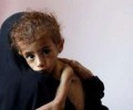 برنامج الغذاء العالمي: اليمن على شفا كارثة إنسانية
