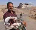 شهداء إثر قصف طيران  العدوان السعودي الغاشم  لمنزل مواطن في الحداء بمحافظة ذمار