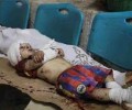 منظمة اليونيسيف:  تحققنا من مقتل 1121 طفلا يمنيا منذ بداية العدوان