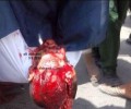 منظمة يمن تدين المجزرة الوحشية التي  ارتكبها قوات الأمن ضد المتظاهرين امام رئاسة الوزراء بصنعاء