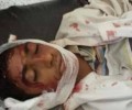 مقتل 8 مواطنين وجرح 12 في إنفجار 3عبوات بعمران وتفكيك 5 عبوات اخر شمال اليمن