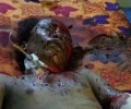 استشهاد 16 مواطنا وإصابة آخرين في سلسلة غارات شنها طيران العدوان على محافظة الحديدة