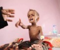 مورنينغ ستار البريطانية: العالم يحتفل برأس السنة بينما 377 الف طفل يموتون بالحصار في اليمن