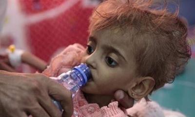 #وكالة دوليه: عدد مرعب لوفيات الاطفال في اليمن